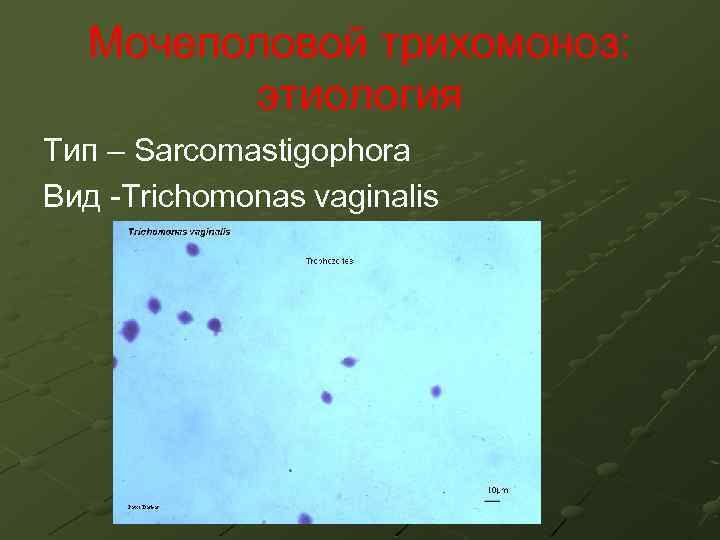 Мочеполовой трихомоноз: этиология Тип – Sarcomastigophora Вид -Trichomonas vaginalis 