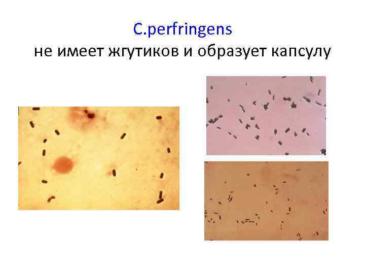 С. perfringens не имеет жгутиков и образует капсулу 