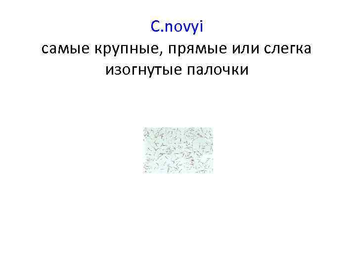 C. novyi самые крупные, прямые или слегка изогнутые палочки 