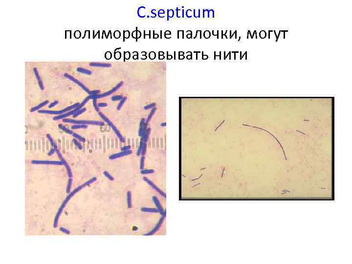 C. septicum полиморфные палочки, могут образовывать нити 