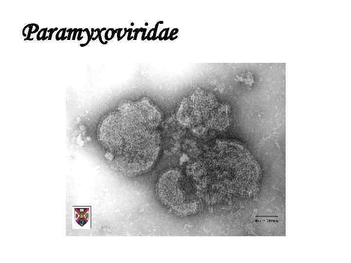 Paramyxoviridae 