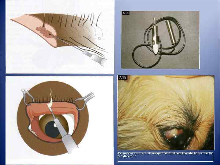 Pekingese that has lid margin deformities after electrolysis with a hyfracator. 