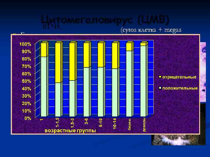 Цитомегаловирус (ЦМВ) ВГЧ 5. n n ВГЧ 5. (cytos клетка + megas Гигантские или