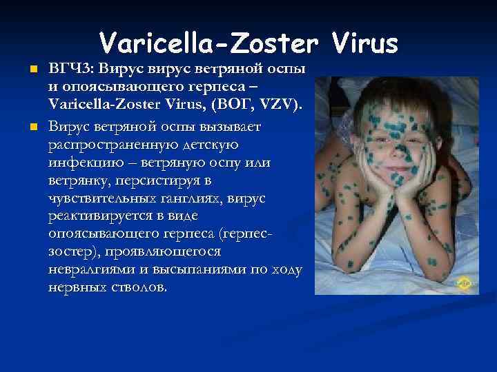 Varicella-Zoster Virus n n ВГЧ 3: Вирус ветряной оспы и опоясывающего герпеса – Varicella-Zoster