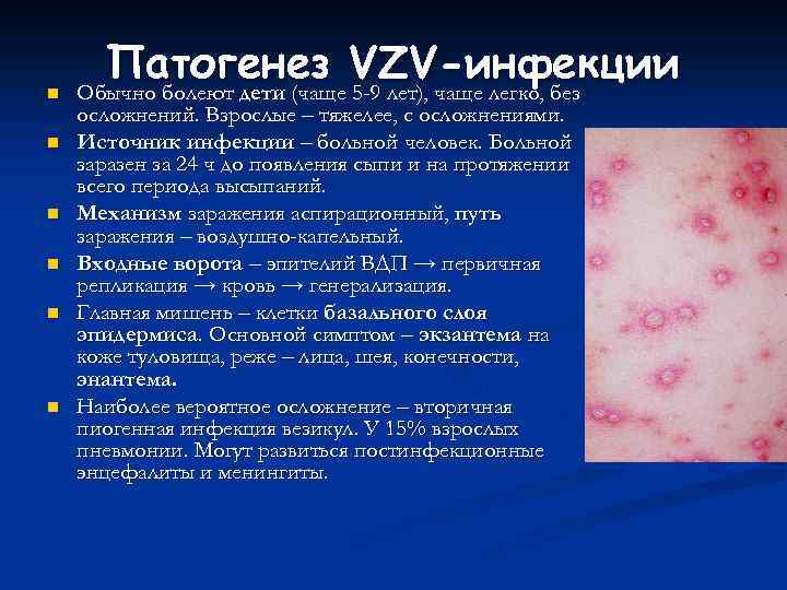 n n n Патогенез VZVчаще легко, без -инфекции Обычно болеют дети (чаще 5 -9