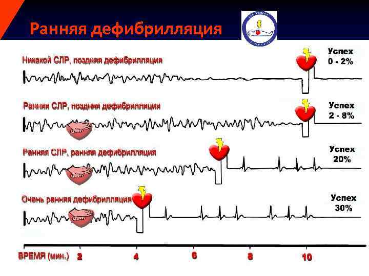 Ранняя дефибрилляция RC (UK) 