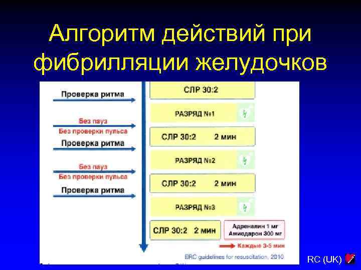 Алгоритм действий при фибрилляции желудочков RC (UK) 