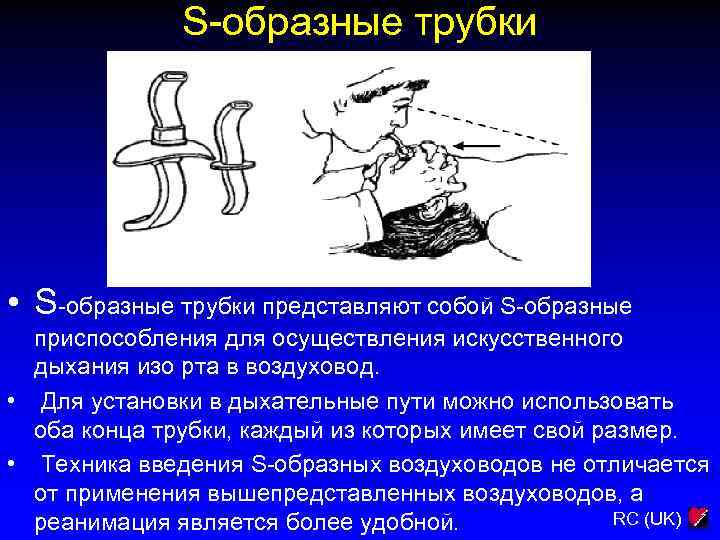 S-образные трубки • S-образные трубки представляют собой S-образные приспособления для осуществления искусственного дыхания изо