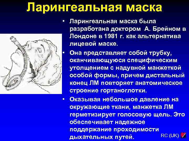Ларингеальная маска • Ларингеальная маска была разработана доктором А. Брейном в Лондоне в 1981