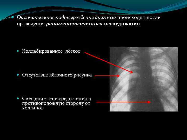  Окончательное подтверждение диагноза происходит после проведения рентгенологического исследования. Коллабированное лёгкое Отсутствие лёгочного рисунка