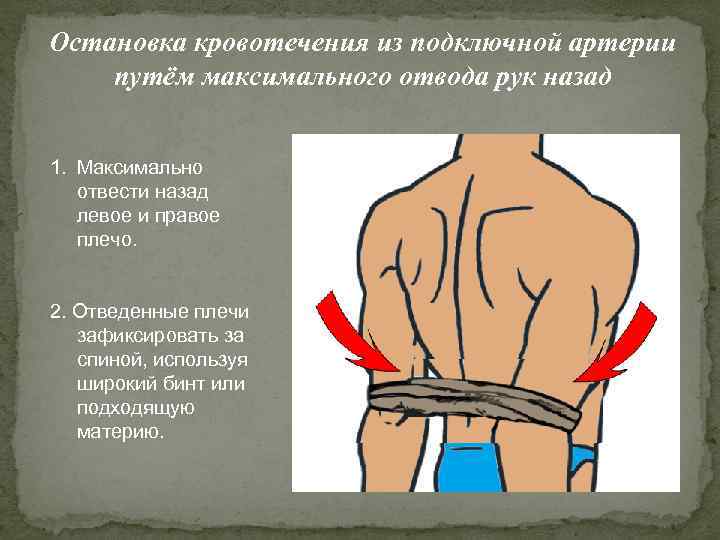 Остановка кровотечения из подключной артерии путём максимального отвода рук назад 1. Максимально отвести назад
