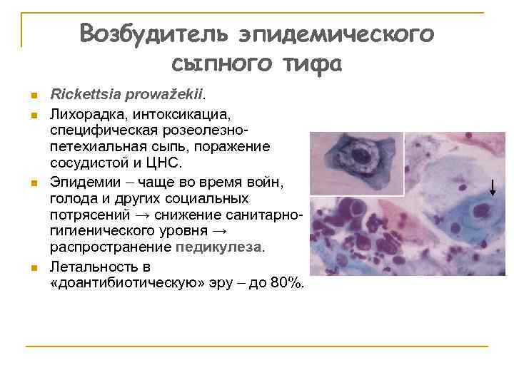 Возбудитель эпидемического сыпного тифа n n Rickettsia prowažekii. Лихорадка, интоксикациа, специфическая розеолезнопетехиальная сыпь, поражение