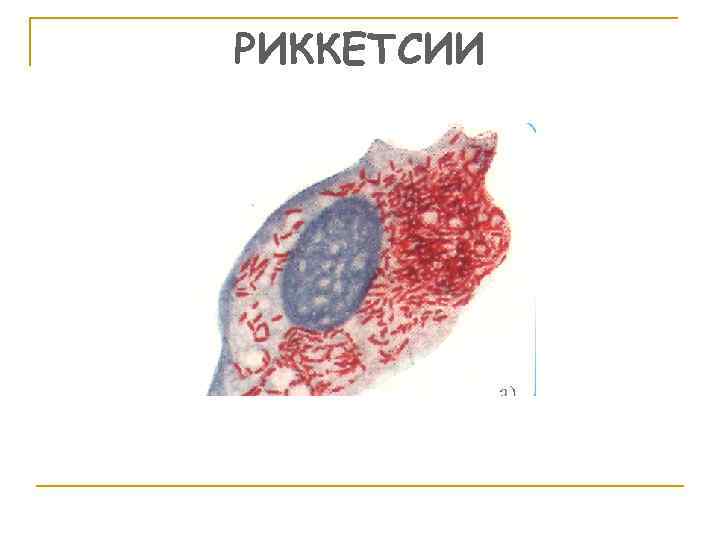 РИККЕТСИИ 