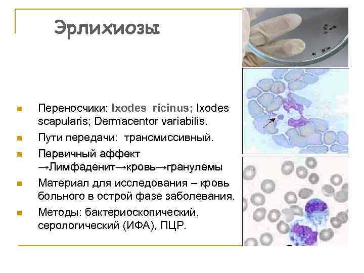 Эрлихиозы n n n Переносчики: Ixodes ricinus; Ixodes scapularis; Dermacentor variabilis. Пути передачи: трансмиссивный.
