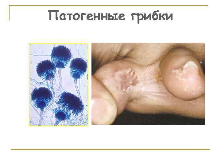 Патогенные грибки 