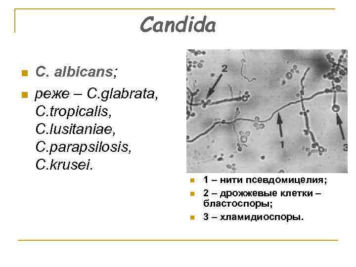Candida n n C. аlbicans; реже – C. glabrata, C. tropicalis, C. lusitaniae, C.