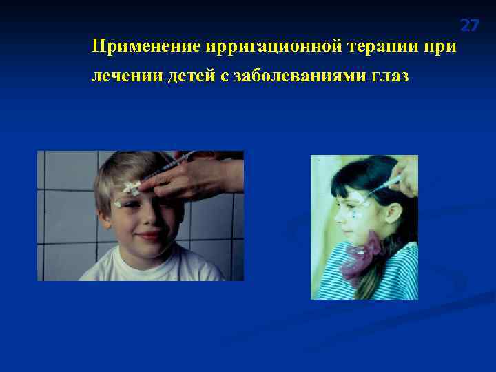 Применение ирригационной терапии при лечении детей с заболеваниями глаз 27 
