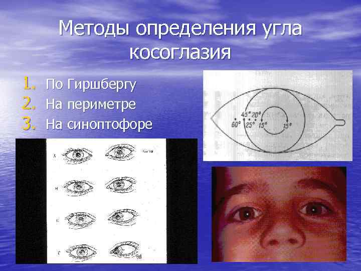 Программа для исправления косоглазия на андроид