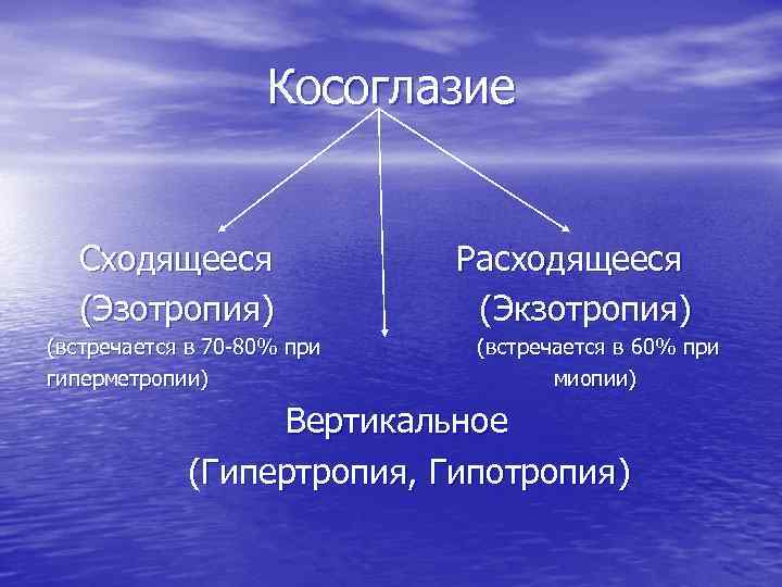 Косоглазие Сходящееся (Эзотропия) (встречается в 70 -80% при гиперметропии) Расходящееся (Экзотропия) (встречается в 60%