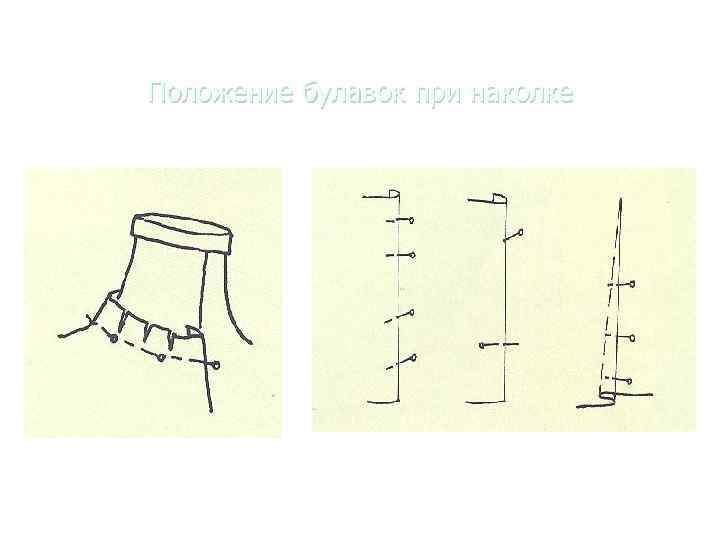 Положение булавок при наколке 