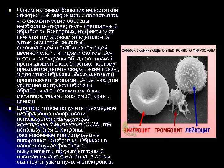 l l Одним из самых больших недостатков электронной микроскопии является то, что биологические образцы