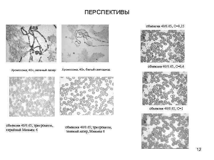 ПЕРСПЕКТИВЫ объектив 40/0. 65, С=0, 15 Хромосома, 40 х, зеленый лазер Хромосома, 40 х,