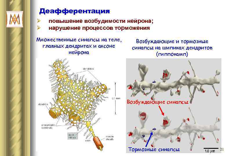 Деафферентация Ø Ø повышение возбудимости нейрона; нарушение процессов торможения Множественные синапсы на теле, главных