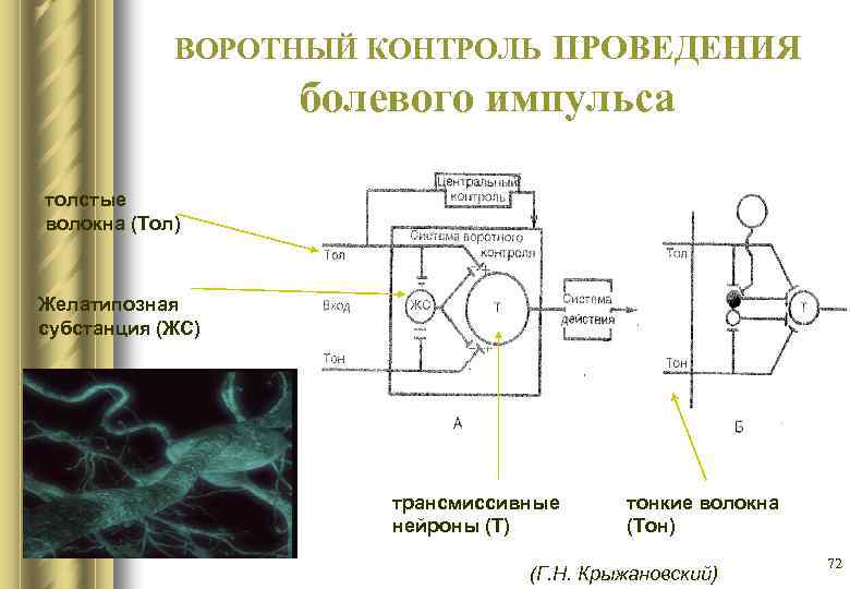 ВОРОТНЫЙ КОНТРОЛЬ ПРОВЕДЕНИЯ болевого импульса толстые волокна (Тол) Желатипозная субстанция (ЖС) трансмиссивные нейроны (Т)