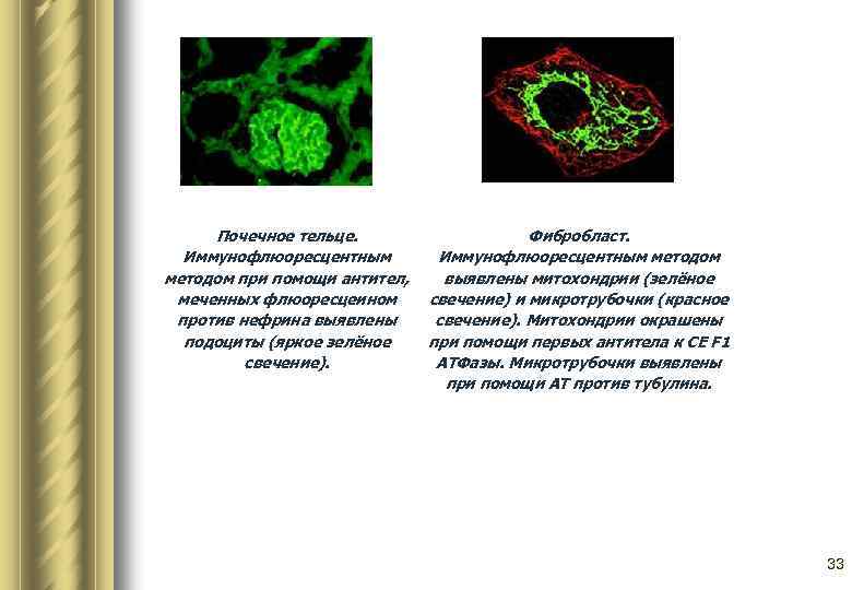 Почечное тельце. Фибробласт. Иммунофлюоресцентным методом при помощи антител, выявлены митохондрии (зелёное меченных флюоресцеином свечение)