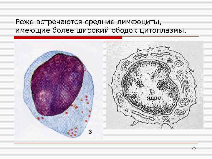 Реже встречаются средние лимфоциты, имеющие более широкий ободок цитоплазмы. 26 