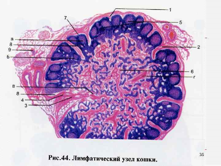 Лимфоузел гистология рисунок