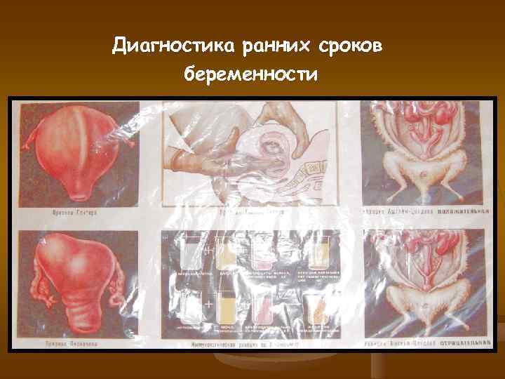 Диагностика ранних сроков беременности 