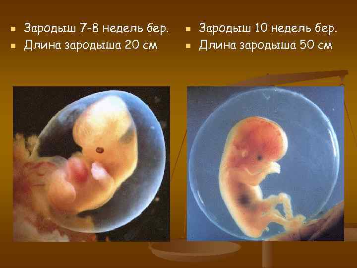 В течении 7 недель 8. Зародыш человека 7-8 недель.
