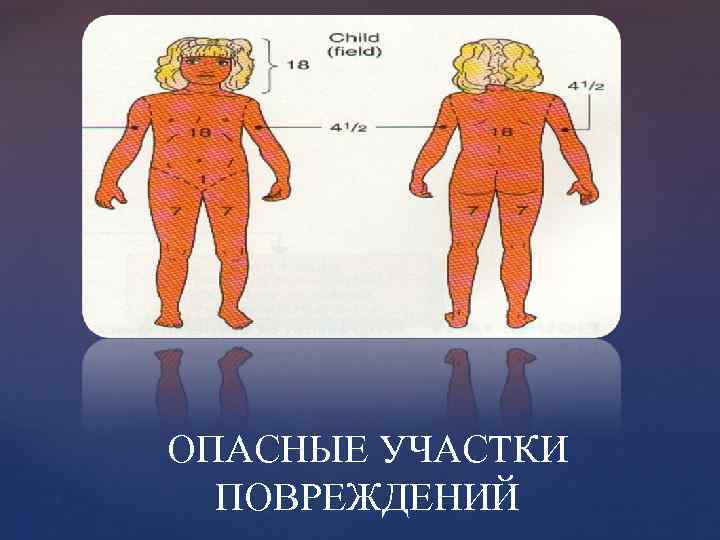 ОПАСНЫЕ УЧАСТКИ ПОВРЕЖДЕНИЙ 