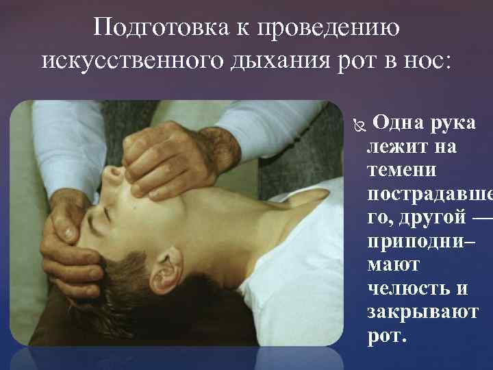 Подготовка к проведению искусственного дыхания рот в нос: Одна рука лежит на темени пострадавше