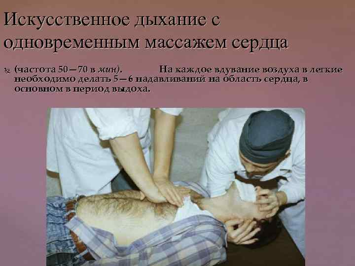 Искусственное дыхание с одновременным массажем сердца (частота 50— 70 в мин). На каждое вдувание