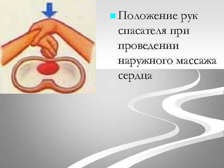 n Положение рук спасателя при проведении наружного массажа сердца 