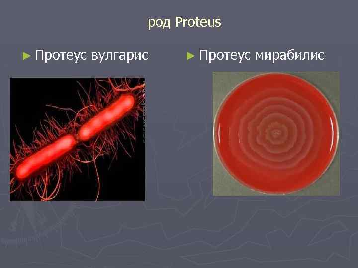 род Proteus ► Протеус вулгарис ► Протеус мирабилис 