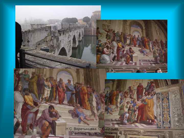 Н. С. Воротынцева. С. С. Гольев Рентгенопульмонология 