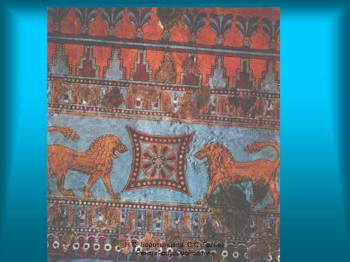 Н. С. Воротынцева. С. С. Гольев Рентгенопульмонология 