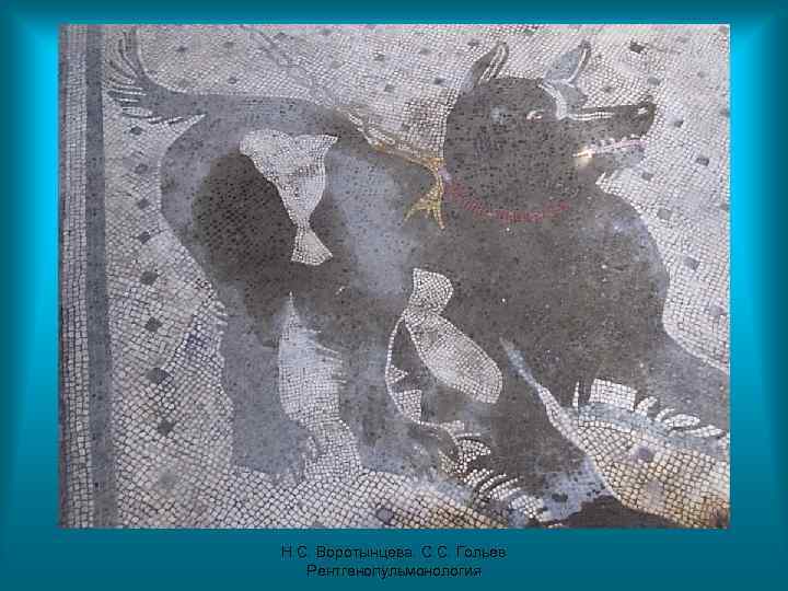 Н. С. Воротынцева. С. С. Гольев Рентгенопульмонология 