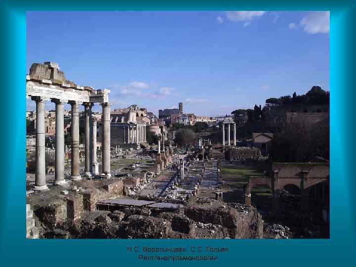 Н. С. Воротынцева. С. С. Гольев Рентгенопульмонология 