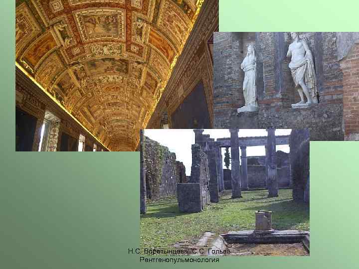 Н. С. Воротынцева. С. С. Гольев Рентгенопульмонология 
