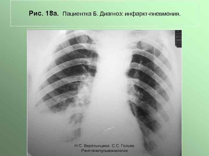 Тотальное затемнение