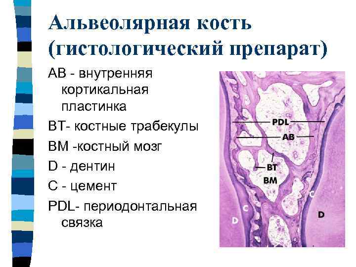 Альвеолярная рабдомиосаркома фото