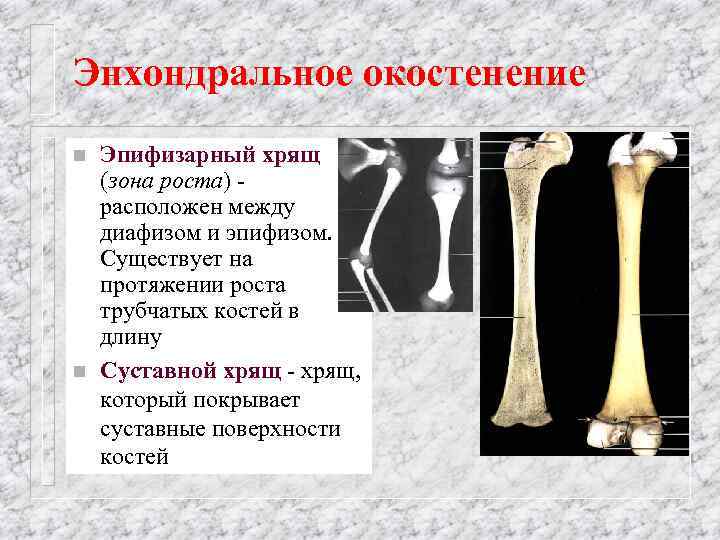 Пластина роста. Эпифизарный хрящ. Эпифизарный хрящ в трубчатой кости. Зона роста трубчатых костей. Эпифизарные зоны роста костей.