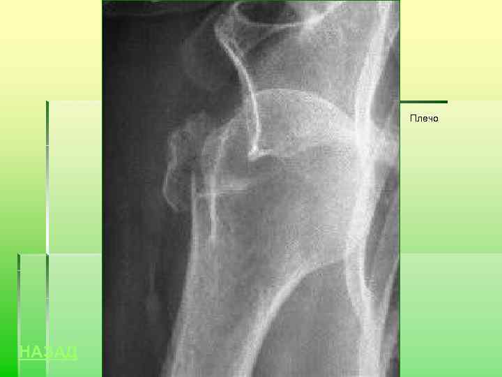 Плечо НАЗАД 