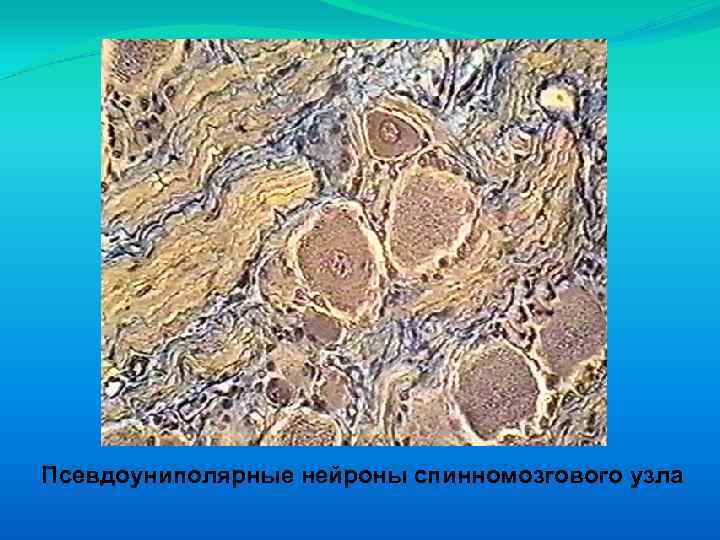 Псевдоуниполярные нейроны спинномозгового узла 