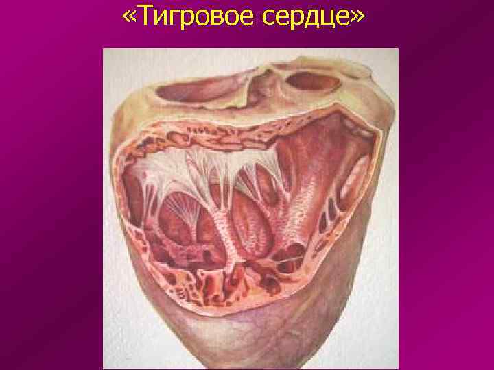  «Тигровое сердце» 