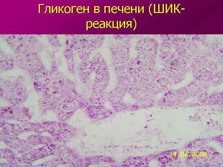 Гликоген в печени (ШИКреакция) 